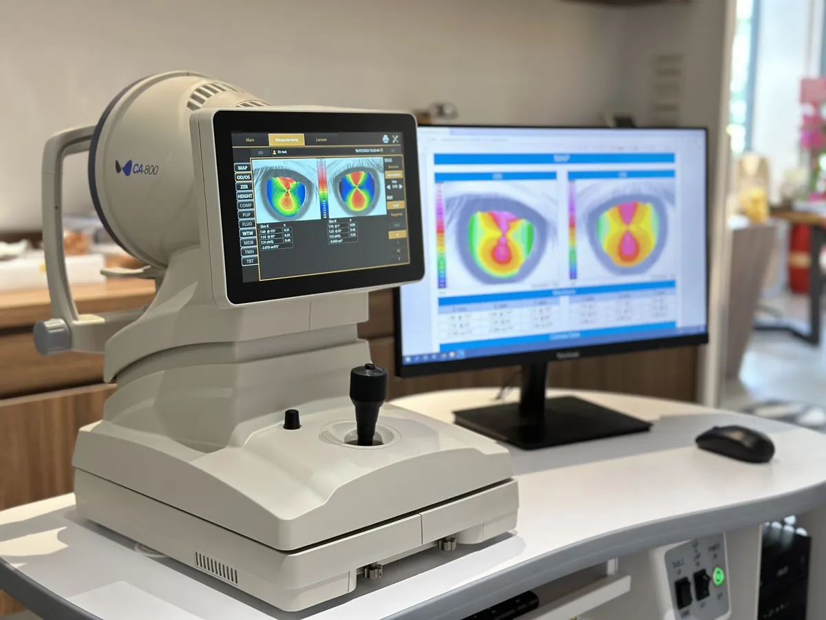 NIDEK CA-800 Corneal Topographer